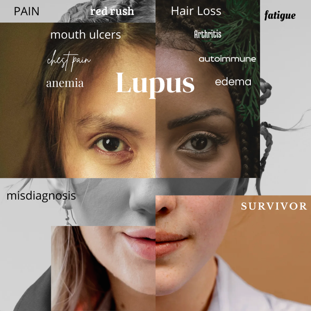 a sample of a lupus ad